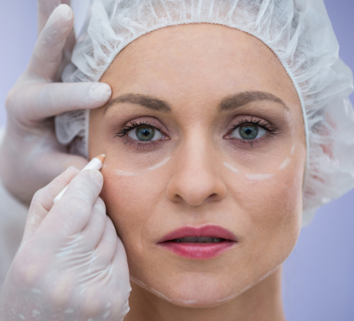 Wrinkle Reducing – 4 Monthly Visit - Single Aea