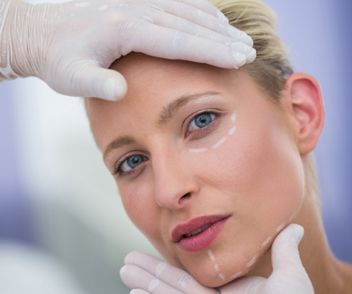 Wrinkle Reducing – 4 Monthly Visit - Extra Area