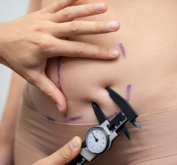 3D HIFU - Abdomen Superficial Fat Removal 