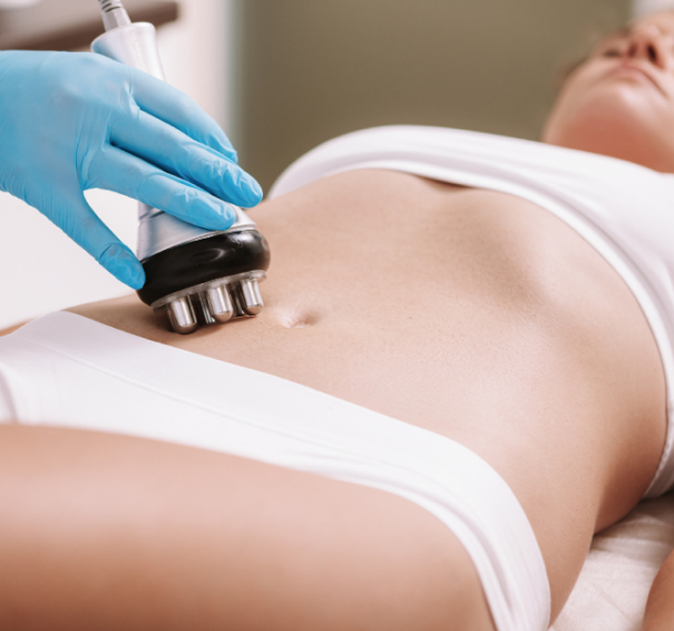 3D HIFU - Abdomen Deep Fat Removal 