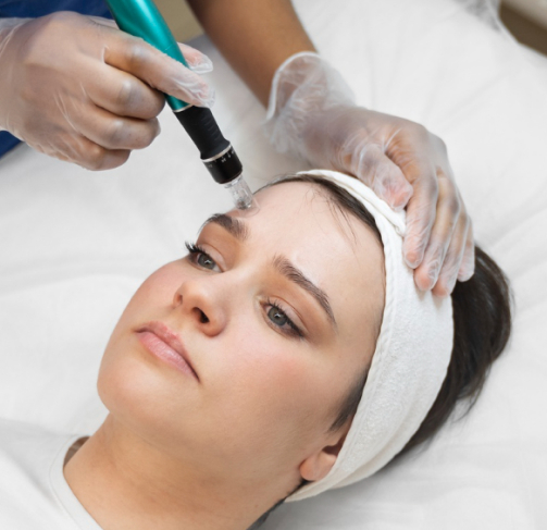 Dermapen - Skin Analysis & Consultation  