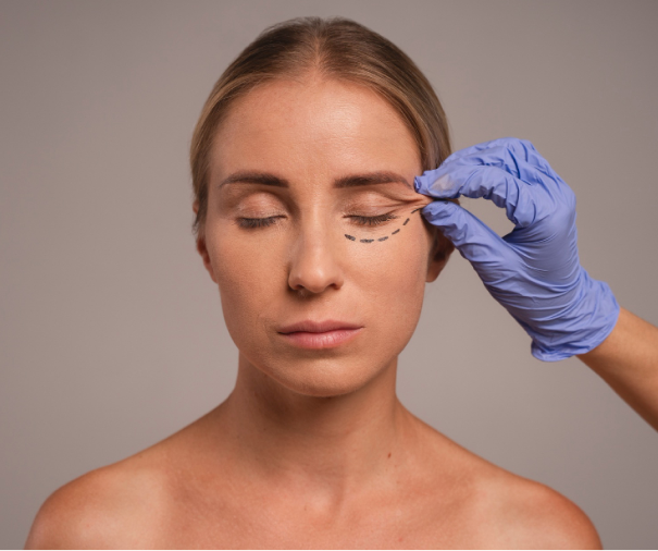 Tear Trough Treatment 