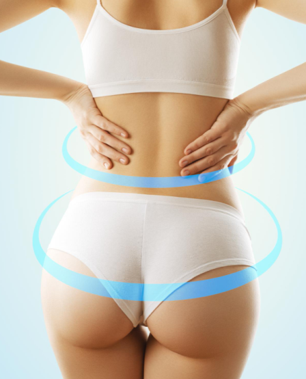 3D HIFU - Superficial Fat Removal - Buttocks 